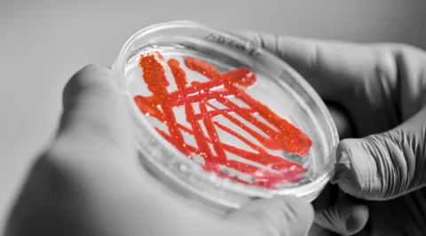 A Petri dish containing a red culture is being examined in a laboratory. The image illustrates research steps in microbiology and biotechnology, in which microorganisms are specifically analysed and cultivated.