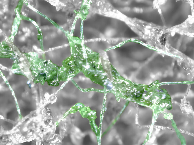 Mikroskopaufnahme eines Scotch-Kratzpads