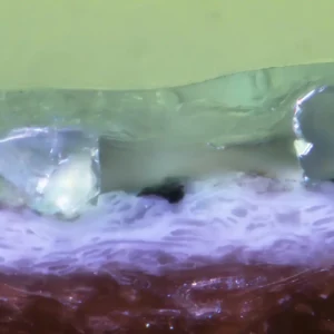 Mikroskopische Querschliffaufnahme (100 µm Maßstab) einer Schicht mit eingebetteten Korundpartikeln zur Vermessung von Schichtdicken und Untersuchung mikroskopischer Strukturen.